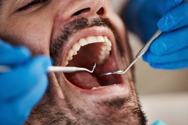 Best Emergency Dental Services for Seniors in East Rochester, NY
